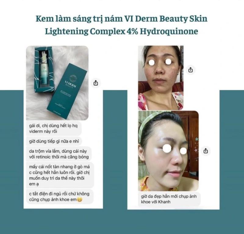 Top 6 kem trị nám chân sâu hiệu quả tại nhà, ngừa tái phát, không bong tróc- Ảnh 3.