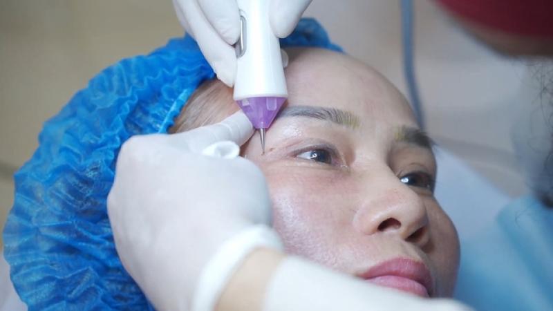 Plasma Gold: Công nghệ tiên phong trong thẩm mỹ, nội khoa hiện đại - Ảnh 2.