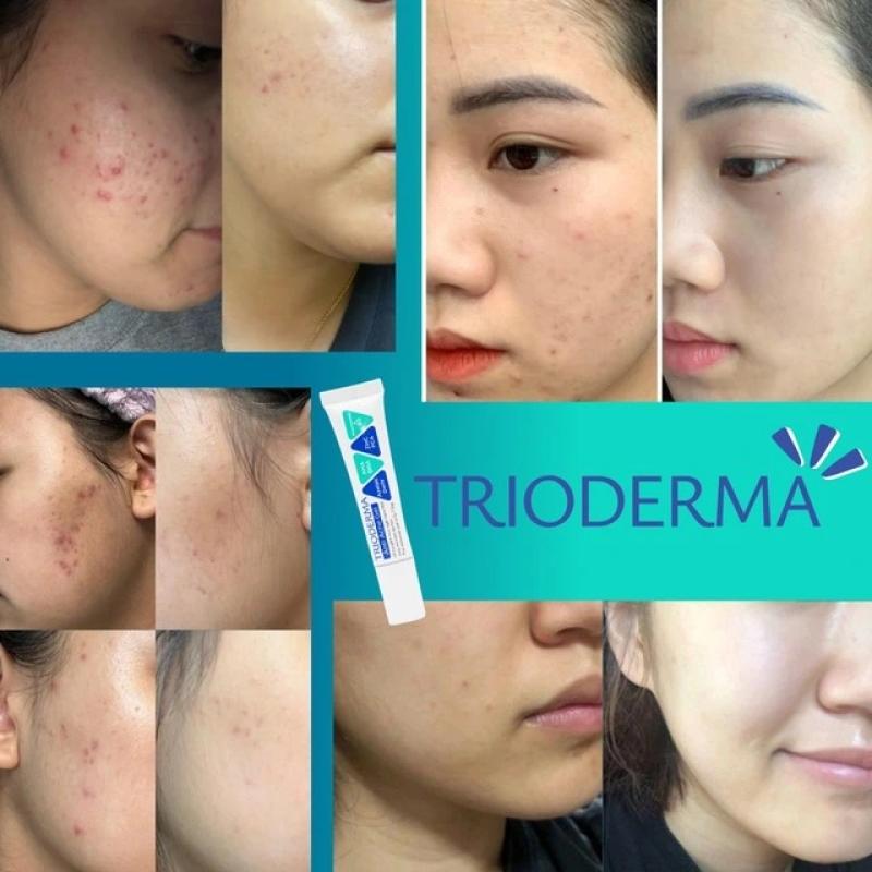 Dược mỹ phẩm Trioderma có tốt không mà được tìm mua nhiều như vậy?  - Ảnh 4.