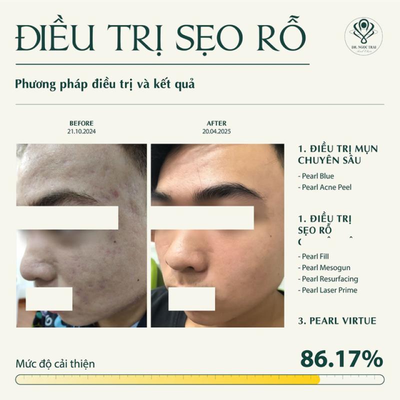 Pearl Premium Clinic - Phòng khám CK Da liễu tiên phong liệu pháp sinh học toàn diện- Ảnh 5.