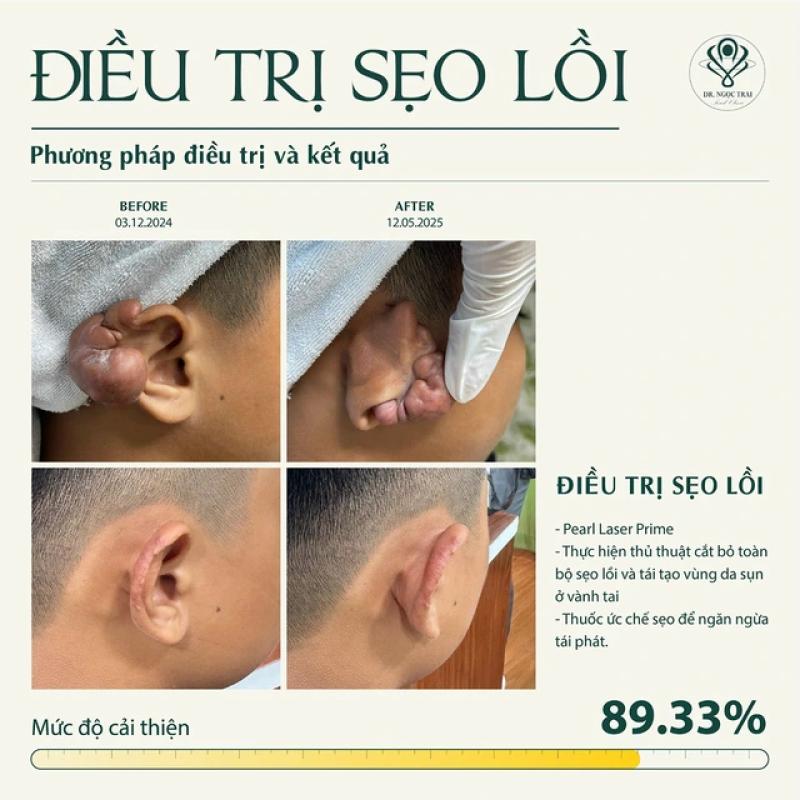 Pearl Premium Clinic - Phòng khám CK Da liễu tiên phong liệu pháp sinh học toàn diện- Ảnh 6.
