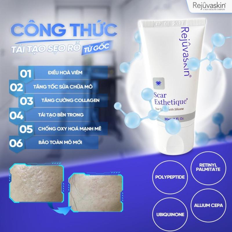 Bật công tắc da rạng rỡ sau mụn tránh xa thâm đỏ lõm- Ảnh 2.