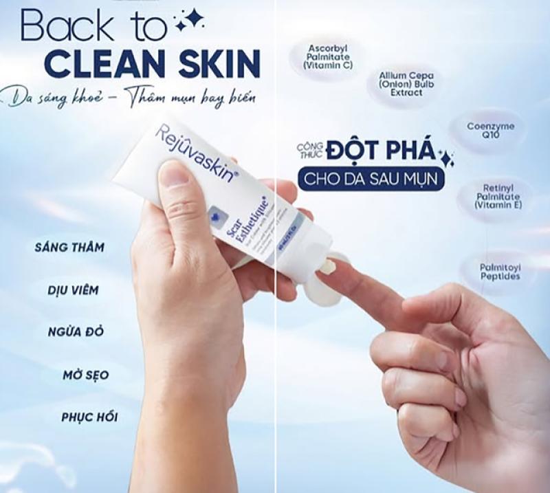 Bật mí cách trị thâm sau khi nặn mụn chuẩn y khoa hiệu quả ngay tại nhà- Ảnh 1.