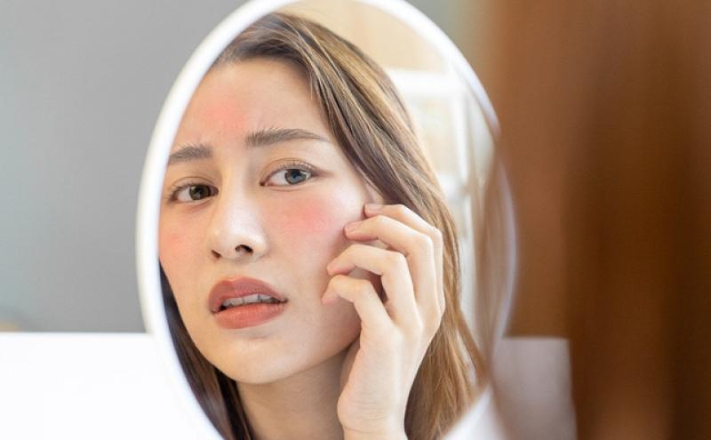 Top 7 sản phẩm làm dịu da đỏ, kích ứng sau laser hiệu quả- Ảnh 1.