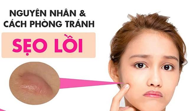 Sẹo lồi: Nguyên nhân và cách điều trị với cả sẹo lâu năm, ngừa tái phát - Ảnh 1.
