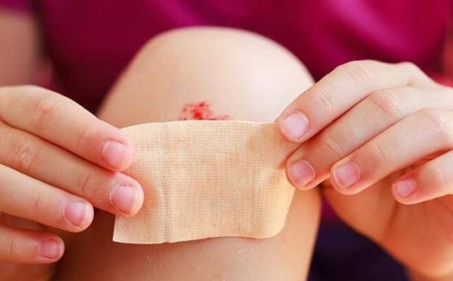 Hướng dẫn cách làm vết thương hở mau khô, nhanh lành và ngừa sẹo ngay tại nhà- Ảnh 8. Hướng dẫn cách làm vết thương hở mau khô, nhanh lành và ngừa sẹo ngay tại nhà- Ảnh 8.