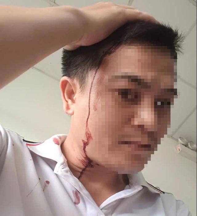 TP.HCM: Nam thanh niên bị người đàn ông tấn công 'vô cớ' trên đường phải nhập viện- Ảnh 2. TP.HCM: Nam thanh niên bị người đàn ông tấn công 'vô cớ' trên đường phải nhập viện- Ảnh 2.