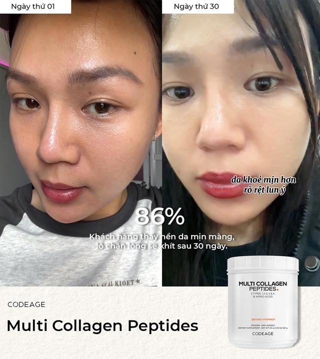 Phụ nữ tuổi 30+ cần phải làm gì ngay để bảo tồn và tăng cường lượng collagen? - Ảnh 1.