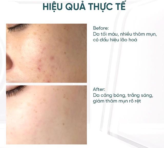  - Ảnh 2.
