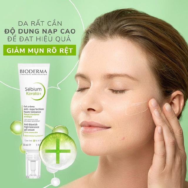 Top 12 kem trị mụn dứt điểm cả mụn thể nặng mà không thâm, không kích ứng - Ảnh 8.