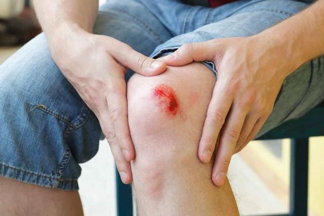Hema - Phác đồ khép kín trong chăm sóc vết thương - Ảnh 2. Hema - Phác đồ khép kín trong chăm sóc vết thương - Ảnh 2.