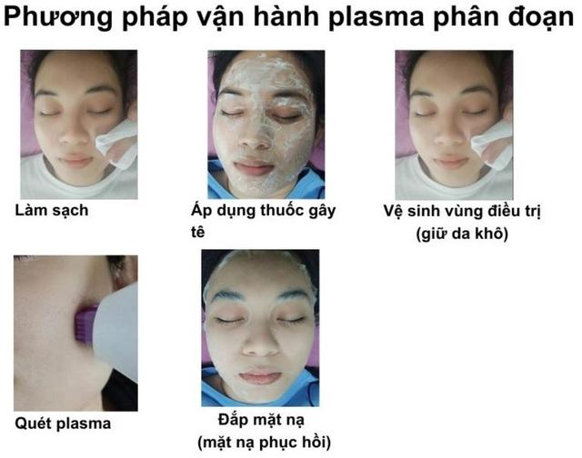 Hướng dẫn sử dụng máy Plasma Gold trong làm đẹp trị sẹo hiệu quả tối ưu - Ảnh 13.