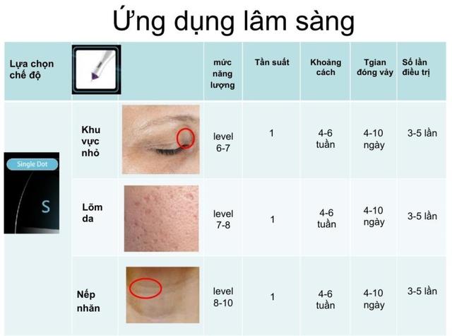 Hướng dẫn sử dụng máy Plasma Gold trong làm đẹp trị sẹo hiệu quả tối ưu - Ảnh 17.