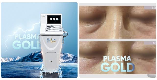 Hướng dẫn sử dụng máy Plasma Gold trong làm đẹp trị sẹo hiệu quả tối ưu - Ảnh 20.
