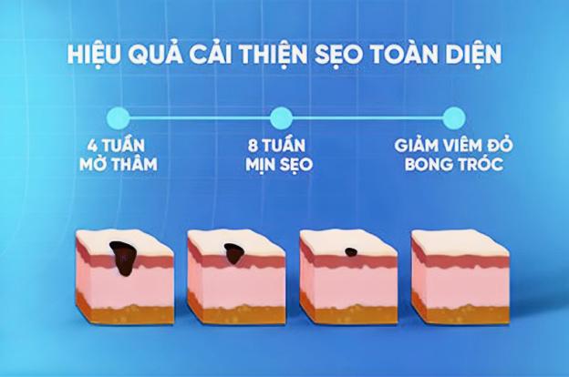 Tạm biệt sẹo rỗ, 5 bí kíp chăm sóc da phục hồi da sau mụn hiệu quả - Ảnh 3.