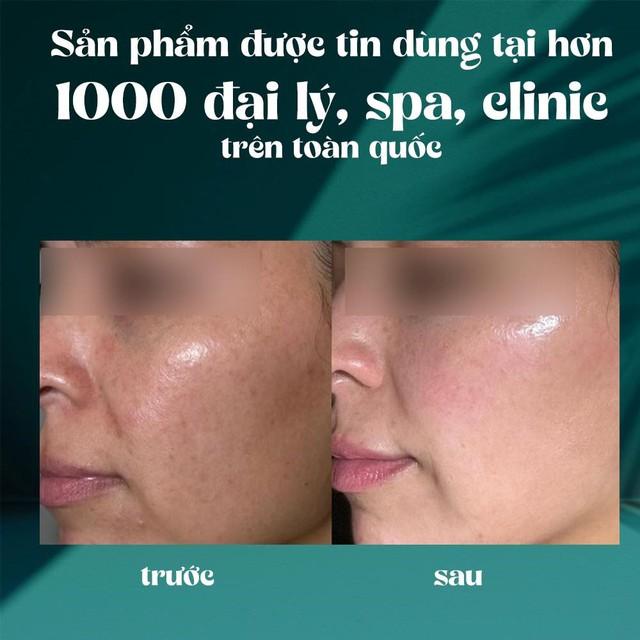 Bí quyết trẻ hóa da tuổi 30+: Vi Derm Retinol Age-Defying Treatment Moisturizer có hiệu quả? - Ảnh 6.