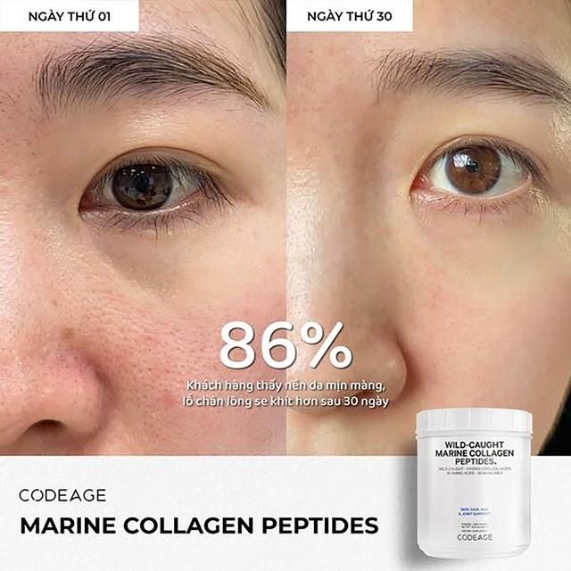 Tác dụng của collagen trong việc làm đẹp khiến phụ nữ 30+ ‘yêu’ hơn cả skincare high-end- Ảnh 11.
