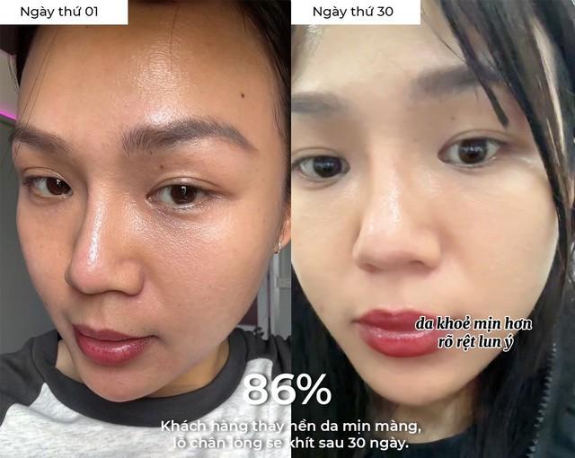 97% phụ nữ bổ sung collagen đúng cách da căng sáng trẻ hơn chục tuổi là thật!- Ảnh 1. 97% phụ nữ bổ sung collagen đúng cách da căng sáng trẻ hơn chục tuổi là thật!- Ảnh 1.