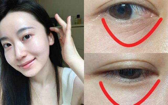 Top 6 Retinol cứ thoa là da căng trẻ, bất chấp tuổi nào cũng ngược về 20+- Ảnh 1.