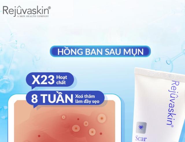 Da hết mụn mà vẫn loang lổ đỏ hồng? 90% chị em đang bỏ qua bước này! - Ảnh 1.