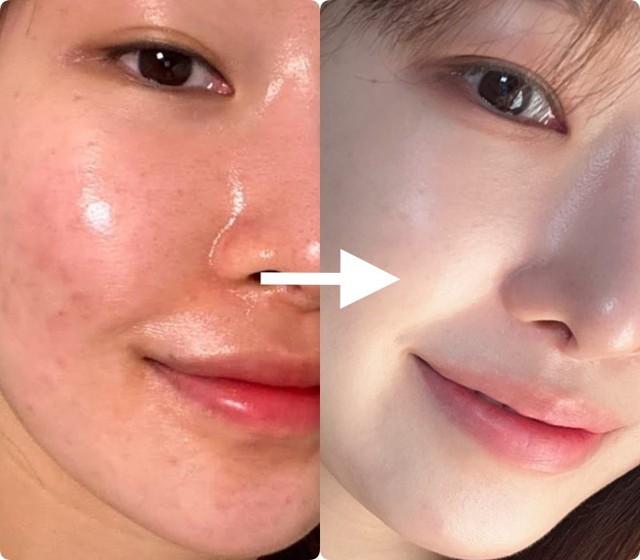 Top 6 kem Retinol hot 2025 giúp da căng mướt, trẻ đẹp không cần filter!- Ảnh 1. Top 6 kem Retinol hot 2025 giúp da căng mướt, trẻ đẹp không cần filter!- Ảnh 1.