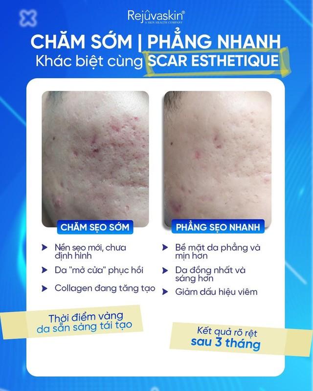 Khám phá năng lực cải thiện sẹo mụn bên trong Scar Esthetique qua 4 tuần - Ảnh 2.