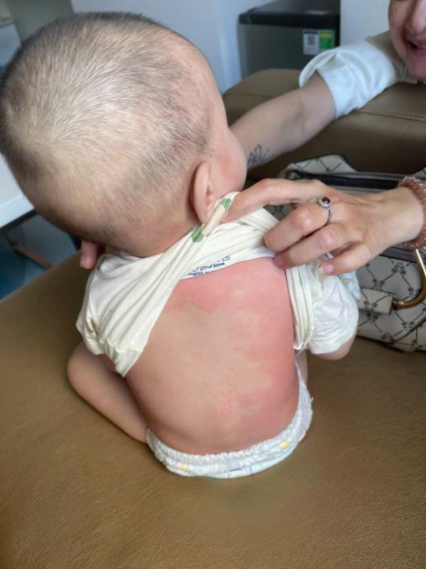 TP.HCM: Trẻ sốt không hạ, đi khám bác sĩ phát hiện mắc bệnh hiếm gặp- Ảnh 2. TP.HCM: Trẻ sốt không hạ, đi khám bác sĩ phát hiện mắc bệnh hiếm gặp- Ảnh 2.