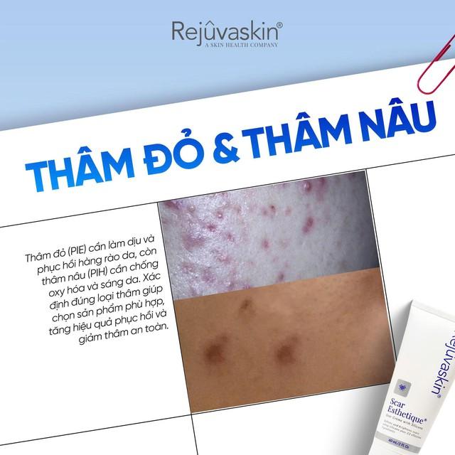 Skincare phục hồi da sau mụn tốt ngừa sẹo rỗ thâm đỏ sau 8 tuần- Ảnh 2. Skincare phục hồi da sau mụn tốt ngừa sẹo rỗ thâm đỏ sau 8 tuần- Ảnh 2.