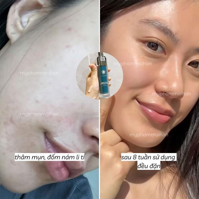 Top 3 kem Retinol êm dịu mà cải thiện nếp nhăn cực đỉnh, muốn già cũng khó- Ảnh 3.