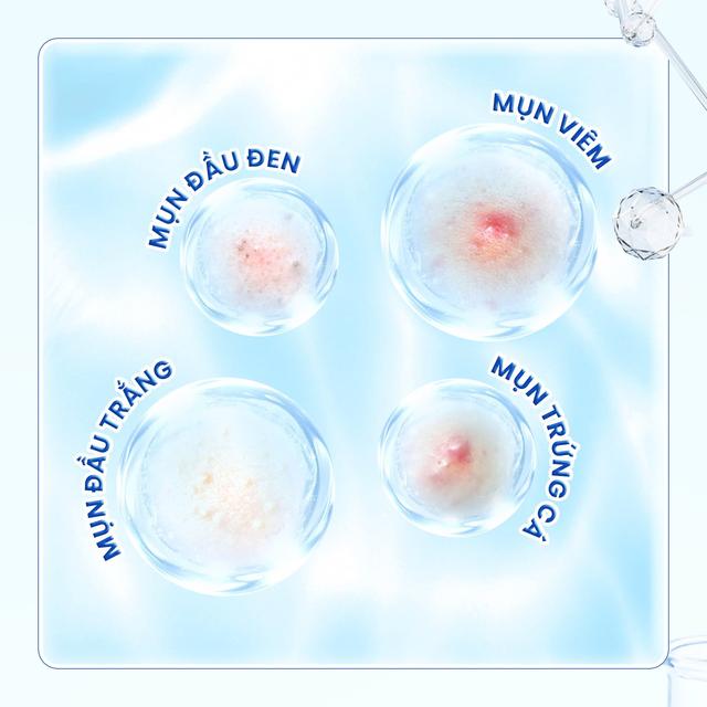 Trioderma - Hành trình thấu hiểu và chăm sóc làn da dầu mụn người Việt- Ảnh 3. Trioderma - Hành trình thấu hiểu và chăm sóc làn da dầu mụn người Việt- Ảnh 3.