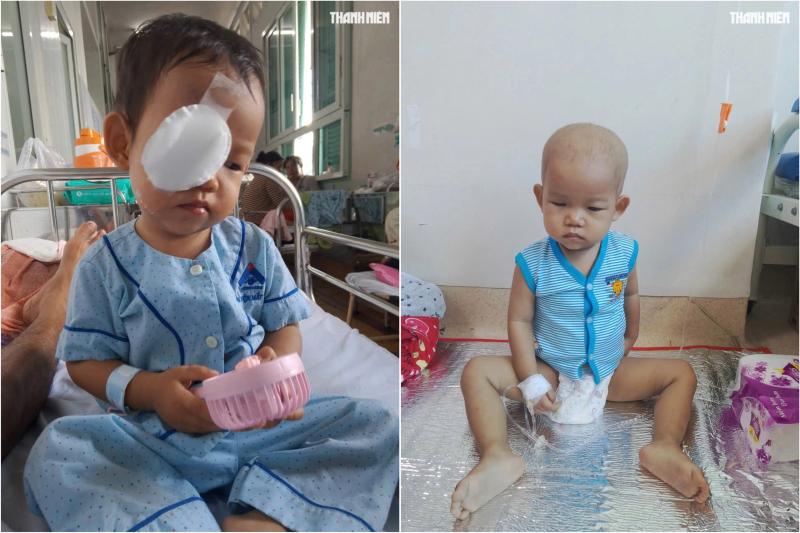 Bé trai nguy cơ mất ánh sáng vì ung thư mắt, gia đình kiệt quệ cầu cứu- Ảnh 2. Bé trai nguy cơ mất ánh sáng vì ung thư mắt, gia đình kiệt quệ cầu cứu- Ảnh 2.
