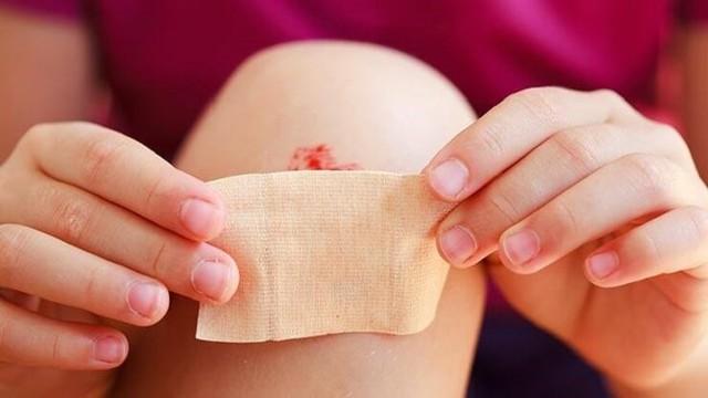 Phòng ngừa nhiễm trùng từ vết thương hở: Bật mí từ chuyên gia da liễu- Ảnh 5. Phòng ngừa nhiễm trùng từ vết thương hở: Bật mí từ chuyên gia da liễu- Ảnh 5.