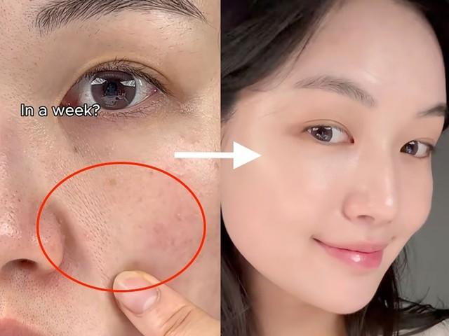 Retinol là gì mà khiến da lão hóa 'chậm lại' sau vài tuần dùng?- Ảnh 7. Retinol là gì mà khiến da lão hóa 'chậm lại' sau vài tuần dùng?- Ảnh 7.