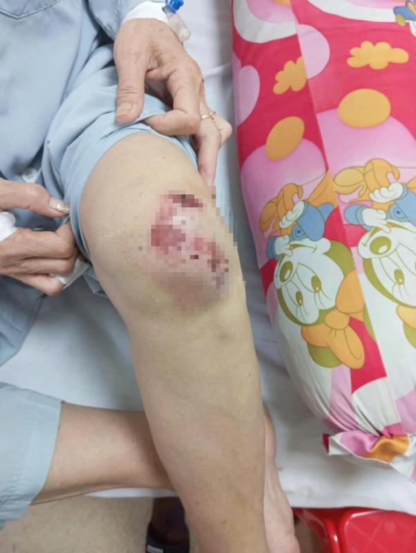 Điều tra vụ người phụ nữ bị tấn công bằng hung khí khi đang tập thể dục - Ảnh 6.