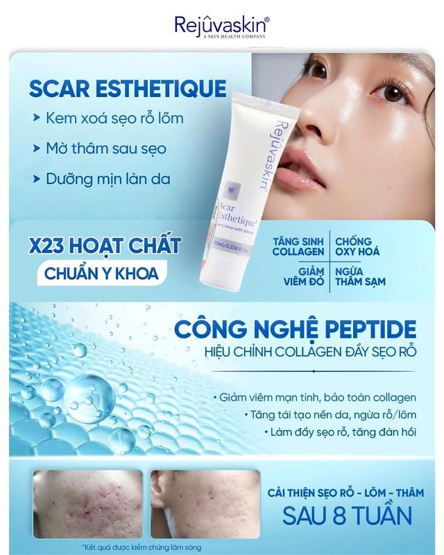 Sẹo mụn hình thành như thế nào? Hiểu nguyên nhân nắm rõ cách xóa sẹo hiệu quả- Ảnh 3. Sẹo mụn hình thành như thế nào? Hiểu nguyên nhân nắm rõ cách xóa sẹo hiệu quả- Ảnh 3.