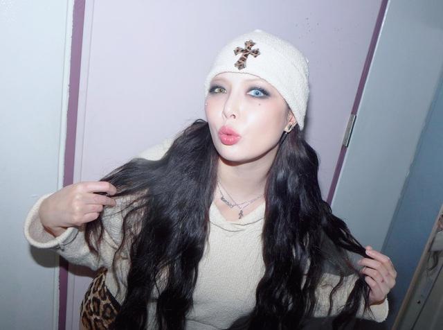 'Nữ hoàng gợi cảm' HyunA xin lỗi sau vụ ngất xỉu trên sân khấu - Ảnh 3.