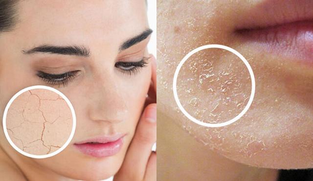 Tuyệt chiêu mới giúp da ẩm mịn, căng bóng ngay trong mùa lạnh hanh khô- Ảnh 2. Tuyệt chiêu mới giúp da ẩm mịn, căng bóng ngay trong mùa lạnh hanh khô- Ảnh 2.