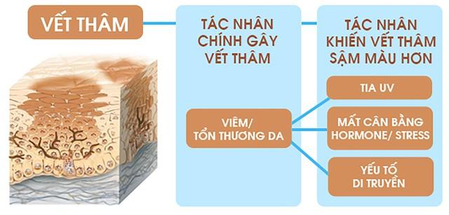 Mụn thâm đen cứng đầu, lâu năm cải thiện bật sáng đều màu sau 7 ngày- Ảnh 3.