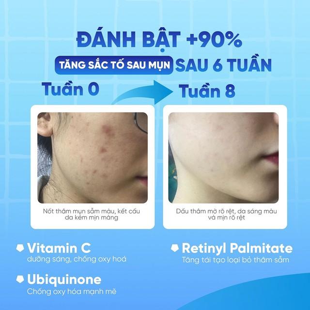  - Ảnh 3.