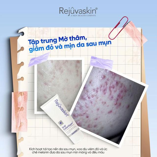 4 tuần giúp da thâm mụn hóa sáng mịn với công thức dịu lành từ thiên nhiên - Ảnh 5.