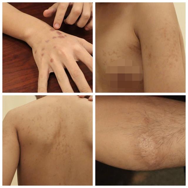 Bẫy lừa đảo xuyên biên giới: Tra tấn bằng nhựa nóng, chích điện- Ảnh 2.