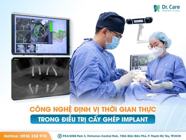 Trồng răng giả nguyên hàm: Giải pháp Implant tiết kiệm tại Dr. Care - Ảnh 3.