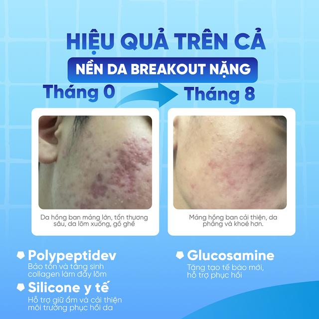 - Ảnh 4. - Ảnh 4.