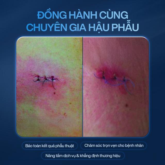 - Ảnh 4. - Ảnh 4.