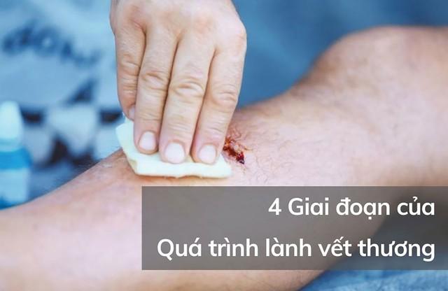 Quá trình lành thương như thế nào, phương pháp giúp phục hồi nhanh ngừa sẹo tối ưu? - Ảnh 1. Quá trình lành thương như thế nào, phương pháp giúp phục hồi nhanh ngừa sẹo tối ưu? - Ảnh 1.