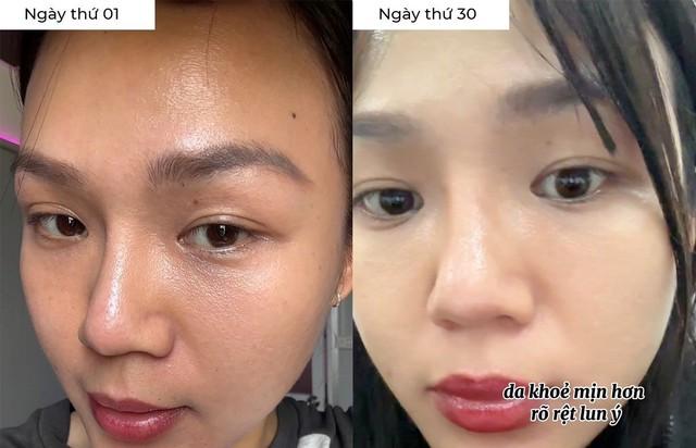 Cảnh báo: Bổ sung collagen sai thời điểm, da không căng trẻ mà còn lão hóa nhanh- Ảnh 1.