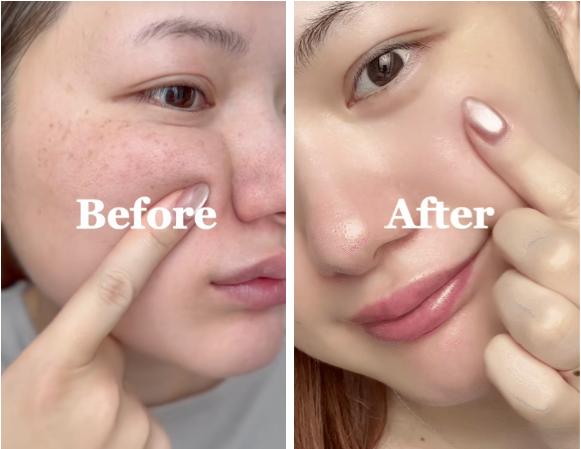 Top 7 serum làm mờ nám đậm, nám sâu tới đâu cũng hiệu quả- Ảnh 1. Top 7 serum làm mờ nám đậm, nám sâu tới đâu cũng hiệu quả- Ảnh 1.