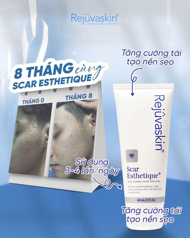 Hướng dẫn sử dụng kem làm mờ sẹo rỗ Rejuvaskin Scar Esthetique đúng chuẩn y khoa - Ảnh 1.