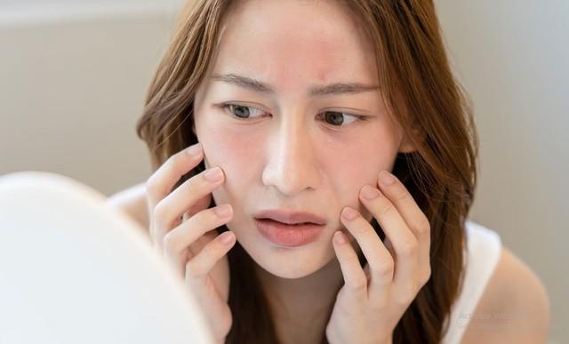Cách dùng mặt nạ dưỡng da tưởng càng đắp càng đẹp, ai ngờ ngược lại- Ảnh 2. Cách dùng mặt nạ dưỡng da tưởng càng đắp càng đẹp, ai ngờ ngược lại- Ảnh 2.
