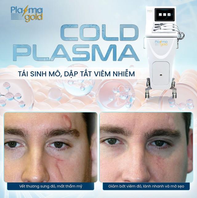 Hé lộ giá máy Plasma Lạnh: Spa, thẩm mỹ viện có đáng để đầu tư không? - Ảnh 3.